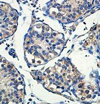 INSL6 antibody