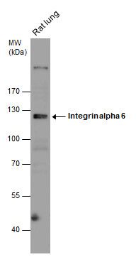 Integrin alpha 6 Rabbit Polyclonal Antibody
