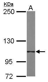 Integrin alpha 6 Rabbit Polyclonal Antibody