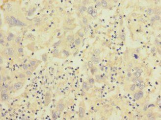ITGB7 Antibody
