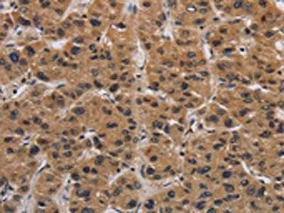 ITGB7 Antibody