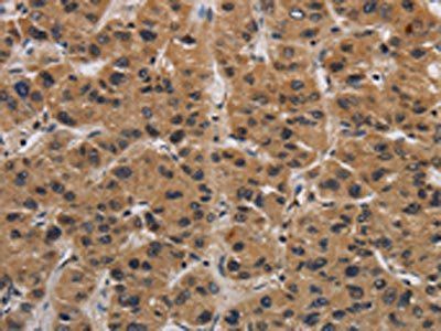 Integrin beta 7 antibody