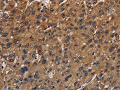 ITGB7 Antibody