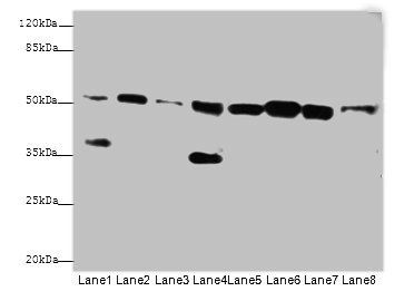 Integrin-linked protein kinase antibody