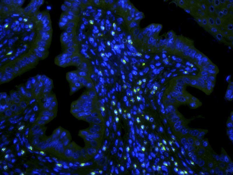 Integrin alpha 5 antibody (FITC)