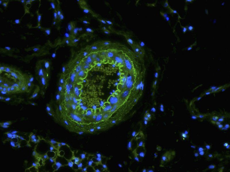 Integrin alpha 5 Rabbit Polyclonal Antibody (FITC)