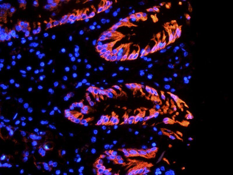 Integrin alpha 5 Rabbit Polyclonal Antibody