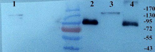 Integrin alpha 5 antibody