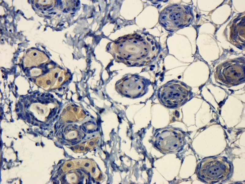 Integrin beta 1 Rabbit Polyclonal Antibody