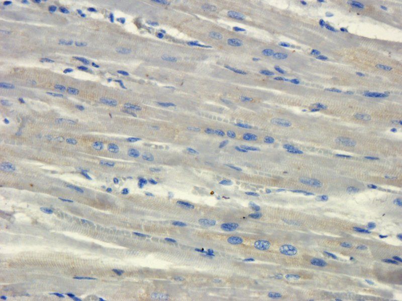 Integrin beta 1 Rabbit Polyclonal Antibody