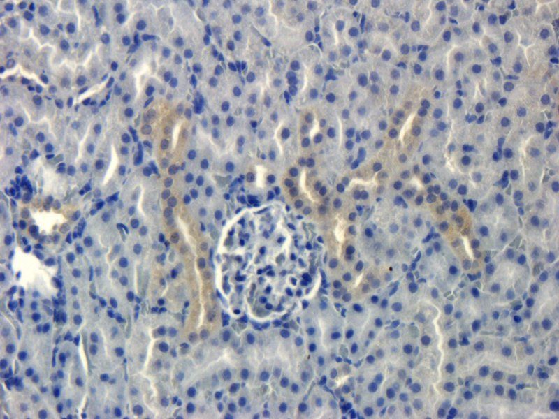 Integrin beta 1 Rabbit Polyclonal Antibody