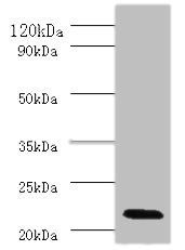 Interferon alpha-2 antibody