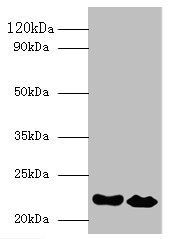 Interferon alpha-21 antibody