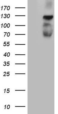 Interferon alpha 6 Antibody