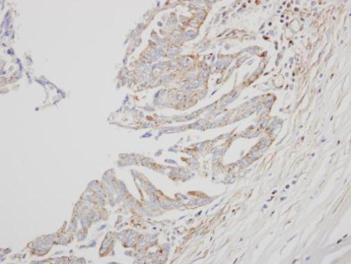 Interferon alpha 8 antibody [N1C3]
