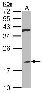 Interferon alpha 8 Rabbit Polyclonal Antibody