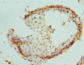 Interferon gamma antibody