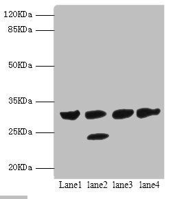 Interferon gamma antibody