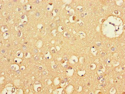 CXCL11 Antibody