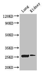 Interferon gamma antibody