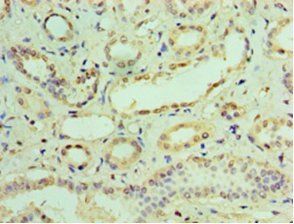 IFIT3 Antibody