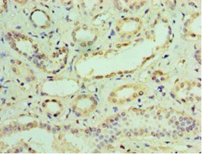 Interferon-induced protein with tetratricopeptide repeats 3 antibody