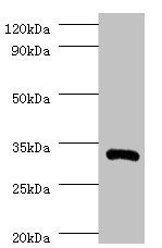 Interleukin-1 beta antibody