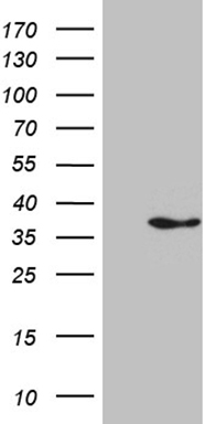 Interleukin 34 (IL34) antibody