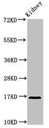 Interleukin-36 R antagonist antibody