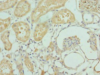 INTS10 antibody