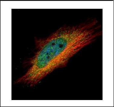 inositol hexakisphosphate kinase 1 Antibody