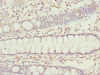 IP6K2 Antibody
