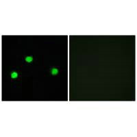 IP6K2 Antibody