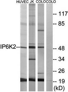 IP6K2 Antibody