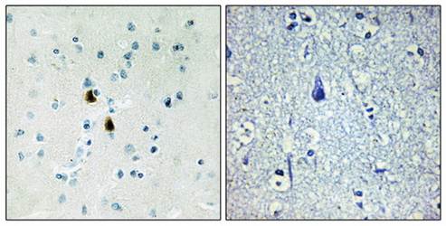 IPKA Antibody