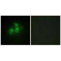 IPPK Antibody