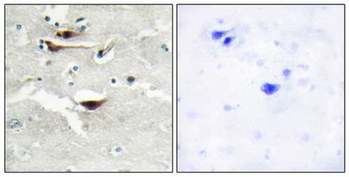 IPPK Antibody