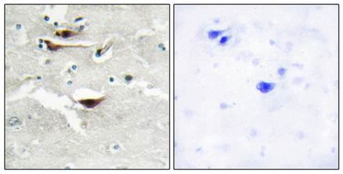 IPPK antibody