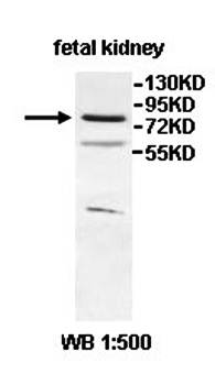 IQCA1 Rabbit Polyclonal Antibody