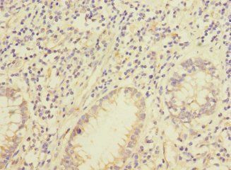IQCC Antibody
