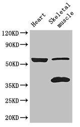 IQCG antibody