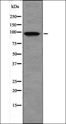 IR (Phospho-Tyr999) antibody
