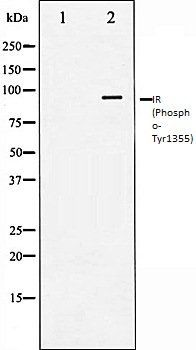IR (Phospho-Tyr1355) antibody