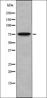 IRAK1 (Phospho-Thr387) antibody