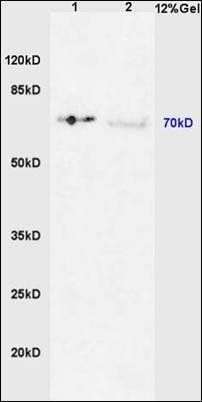 IRAK1 (phospho-Thr387) antibody