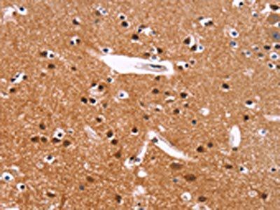 IRAK1BP1 Antibody