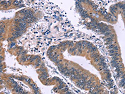 IRAK1BP1 Antibody