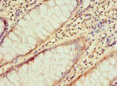 IRAK2 Antibody