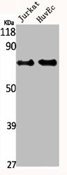 IRAK2 Antibody
