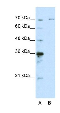 IRAK3 antibody